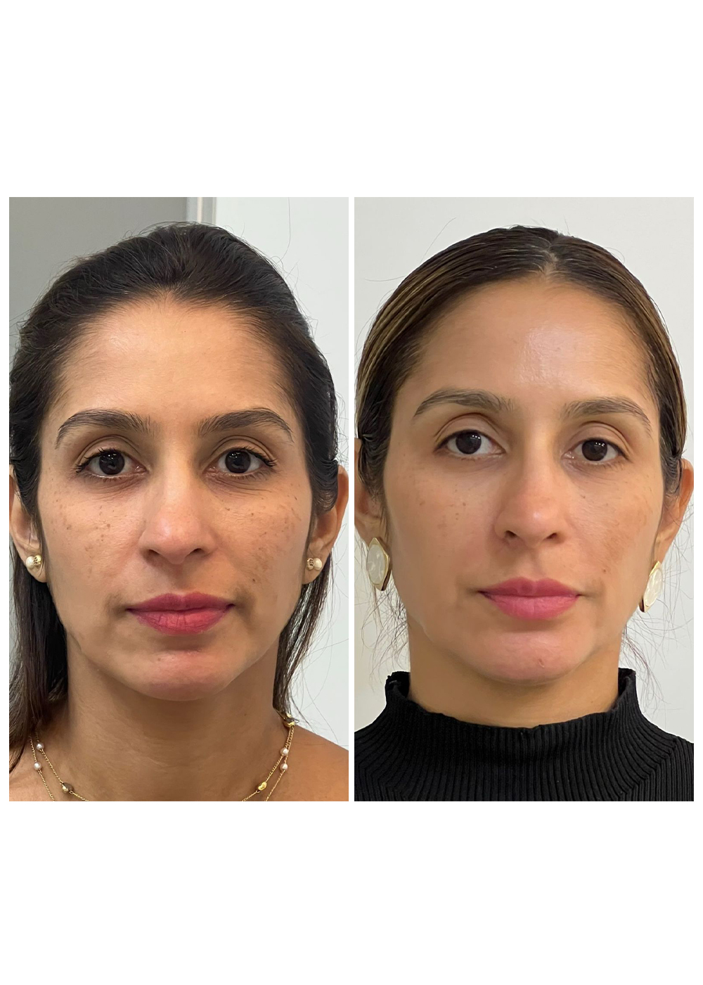Antes-e-Depois-1.jpg