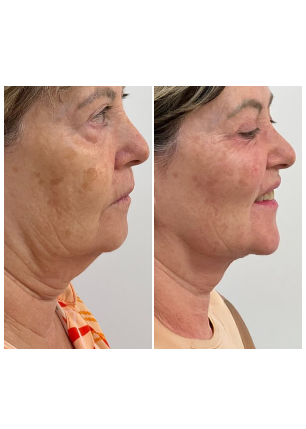 Antes-e-Depois-3.jpg