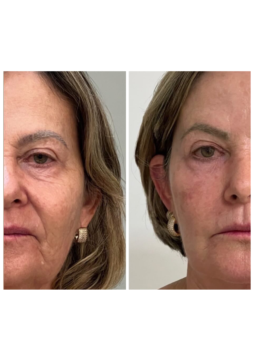 Antes-e-Depois-4.jpg