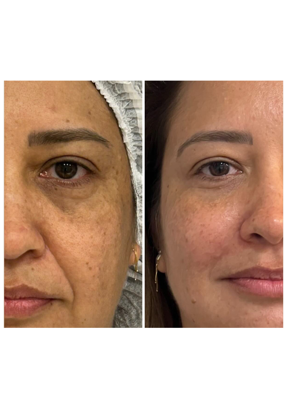 Antes-e-Depois-5.jpg